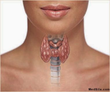 щитовидная железа