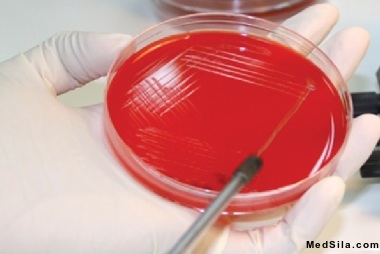 Секторальный посев мочи